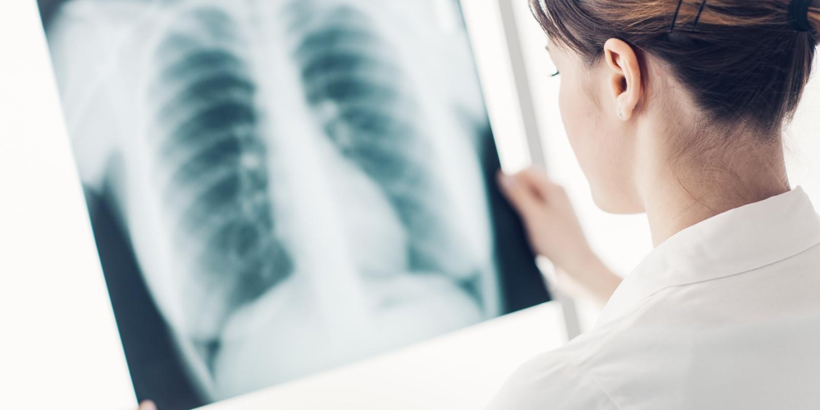 Quais são os exames de imagem que ajudam a diagnosticar doenças pulmonares?