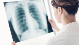 Quais são os exames de imagem que ajudam a diagnosticar doenças pulmonares?